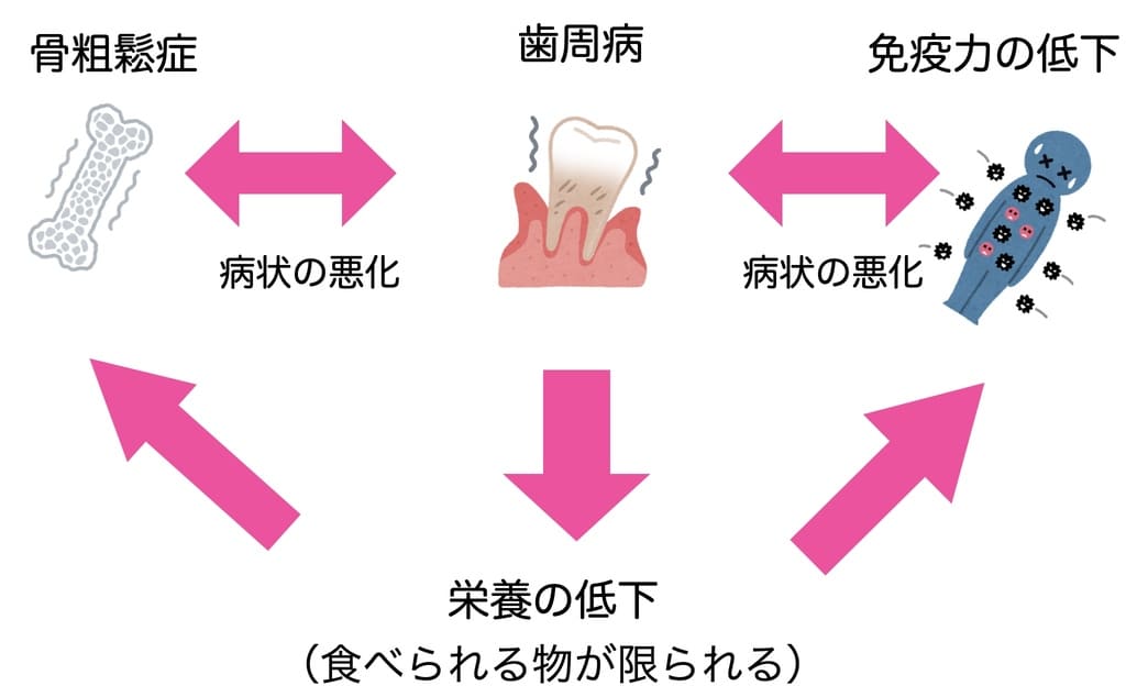 歯周病と骨粗鬆症の関係の画像