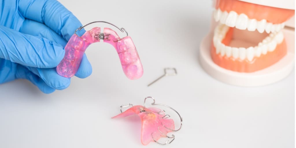 子供の歯科矯正装置の画像