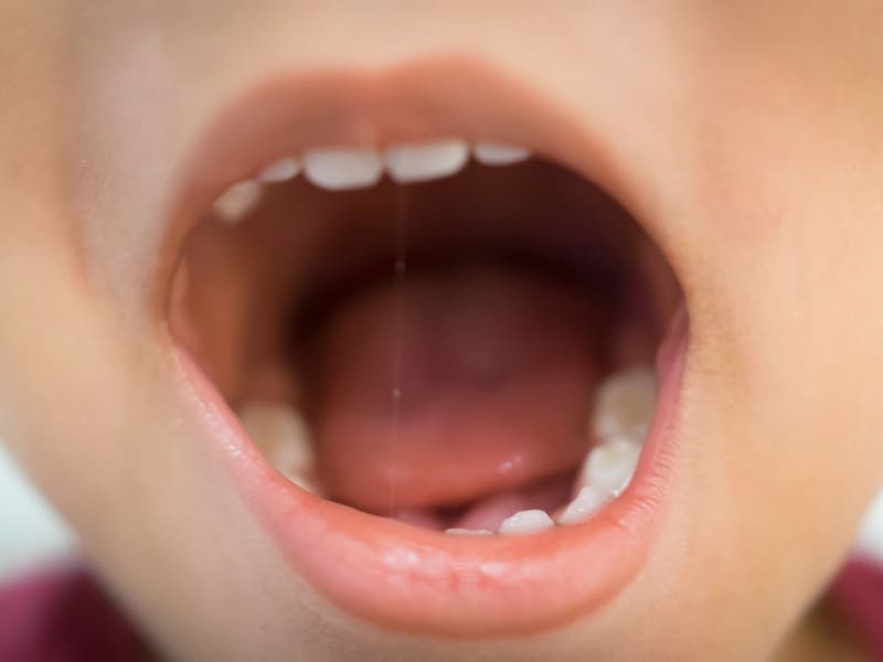 口を開ける子どもの画像