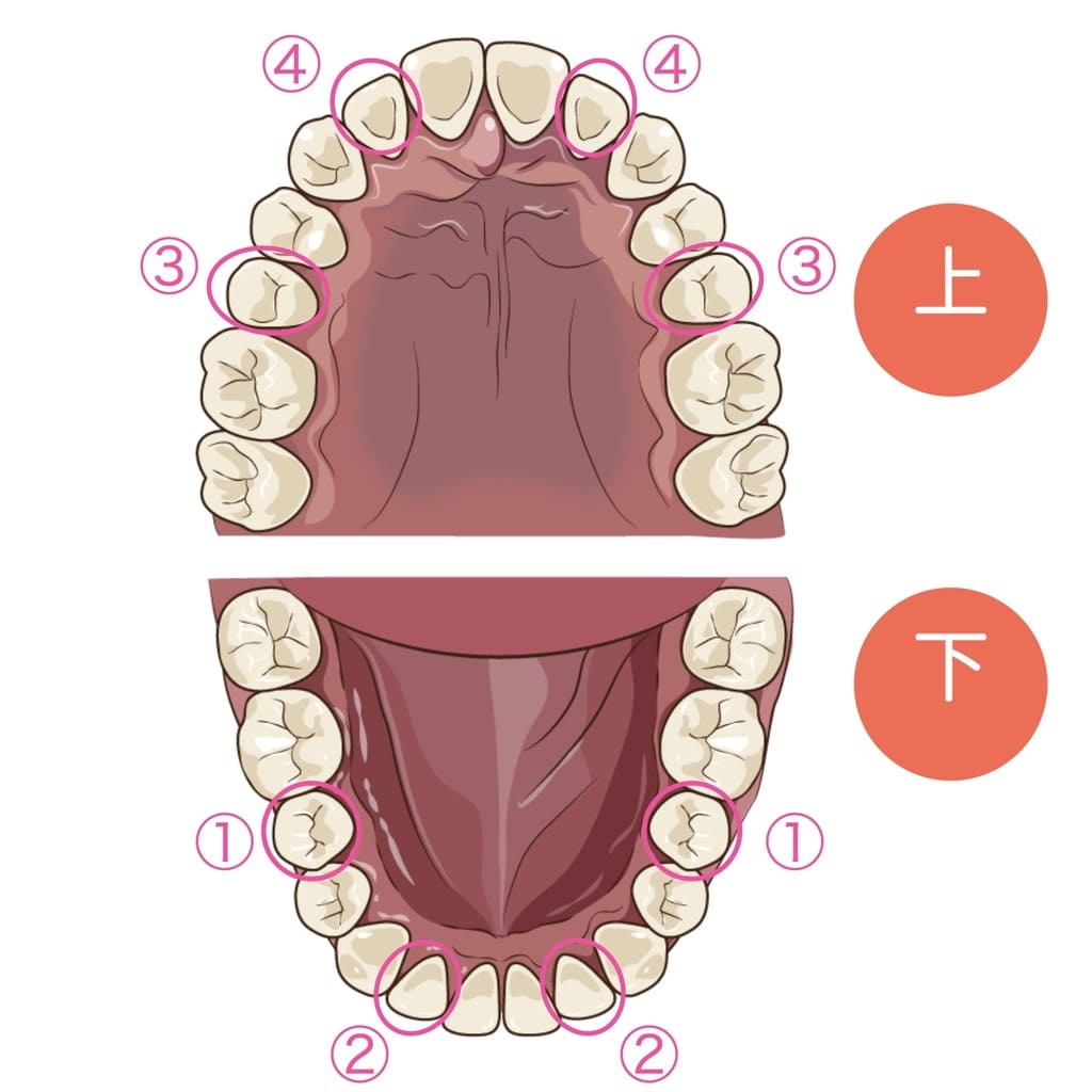 先天的欠如歯の発生頻度が高い部位を示すイラスト画像