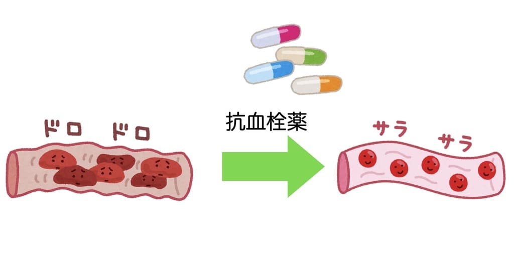 抗血栓薬の働きを示すイラスト画像